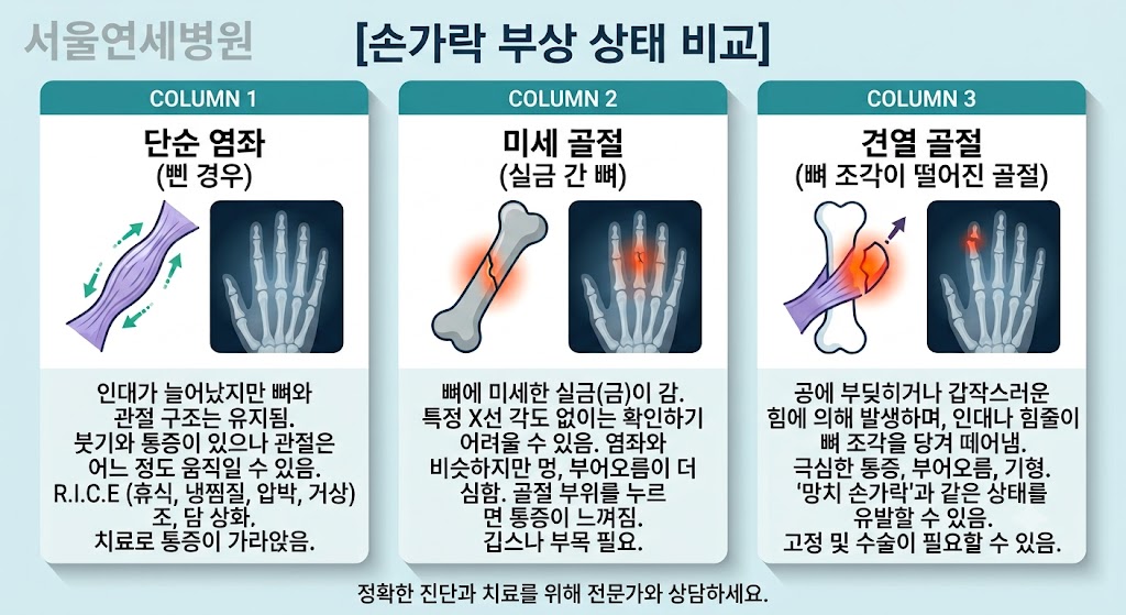 문끼임·피멍 붓기, 미세 골절과 인대 손상 구별하는 손가락 정형외과 대처법